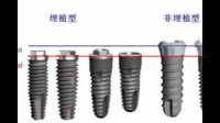 求科普，韩国dio种植体是什么材质？